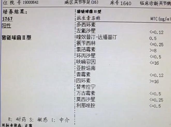 男子因食用未煮熟猪肉致双耳全聋，食品安全意识敲响健康警钟