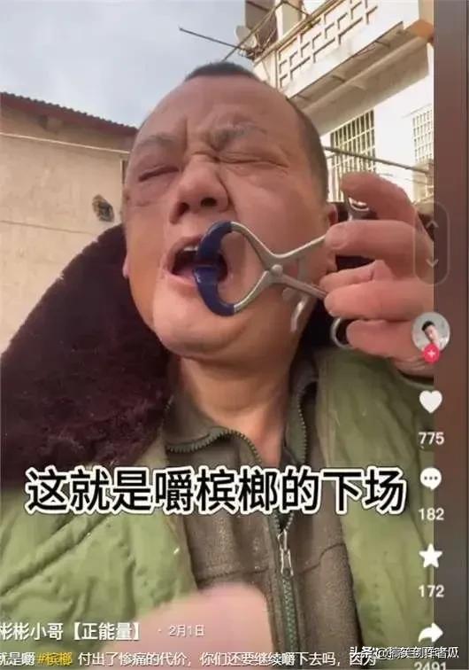 小伙嚼槟榔8年，脸部变形成电视机，槟榔与面部形态的警示故事