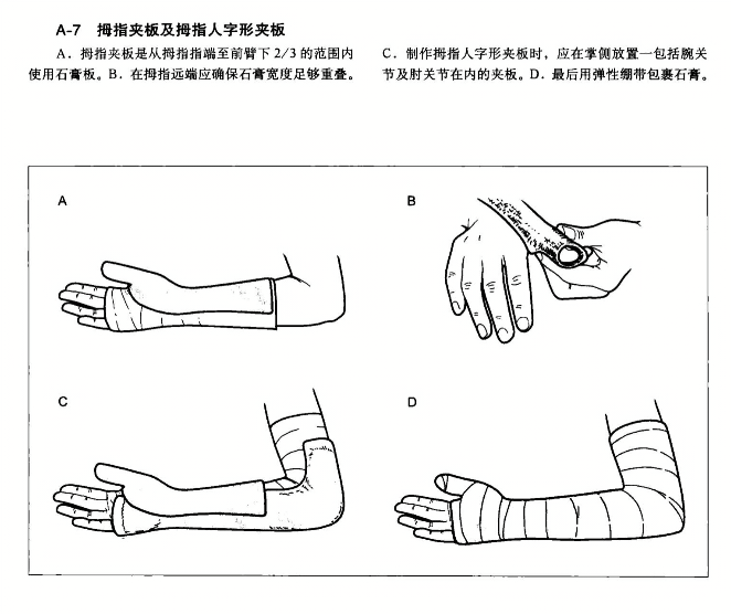 夹板使用指南，正确方法与注意事项