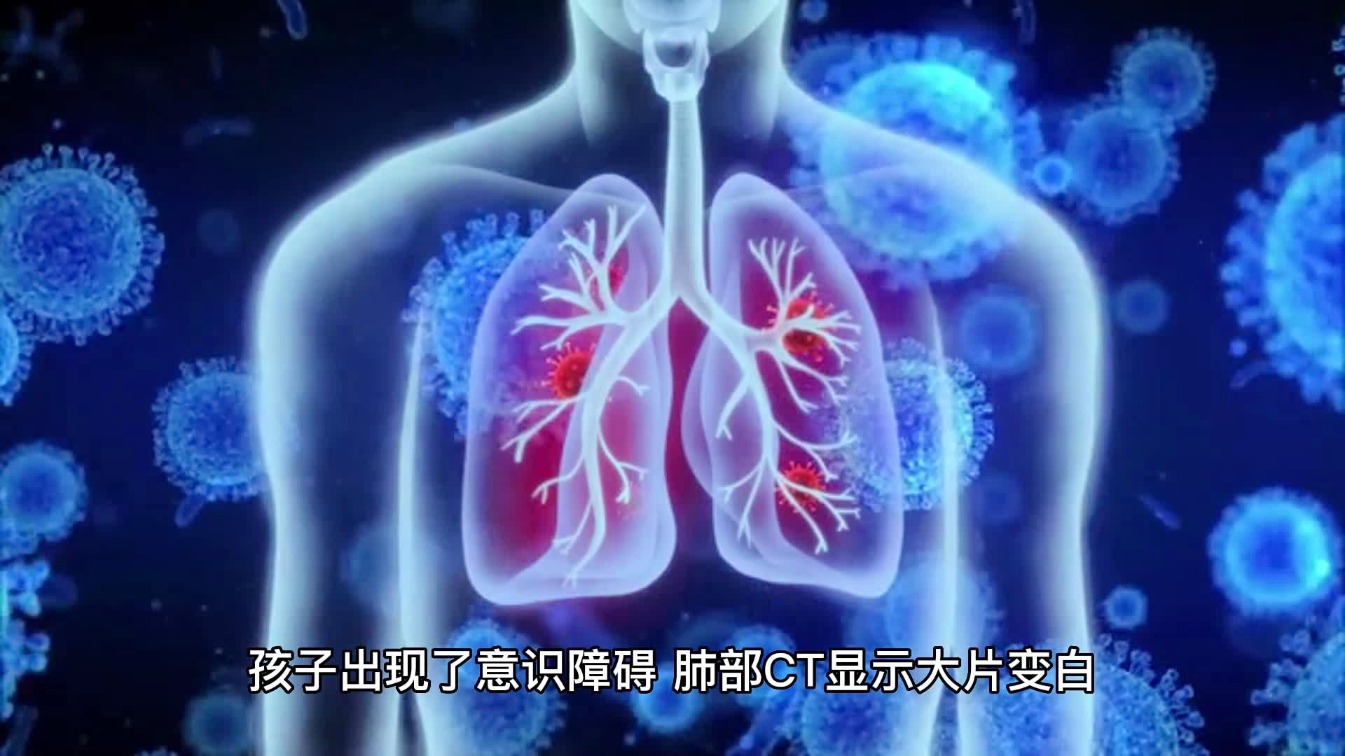 男子流感感染引发白肺危机，流感的危害及预防措施