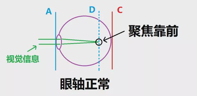 迎太阳闭眼10分钟能否预防近视？——北大人民医院医生的观点及其原理探讨